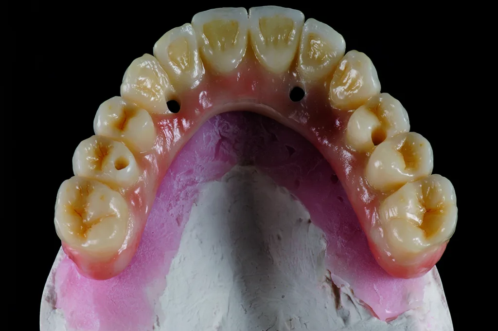 Abb. 26: Finale Restauration