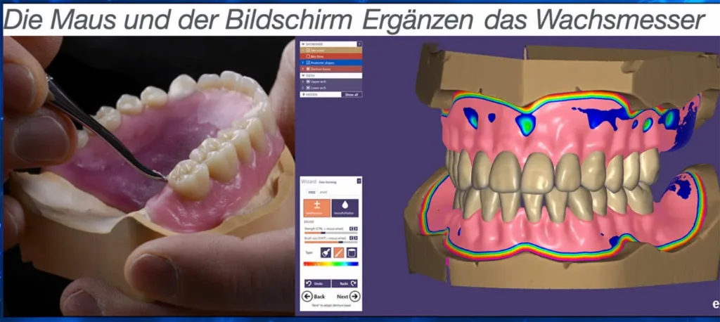 Abb. 3: Für eine optimale Anwendung digitaler Tools sollte man auch die analogen Techniken beherrschen und kann so mit dem Besten aus beiden Welten zum Wohle der Patienten arbeiten. 