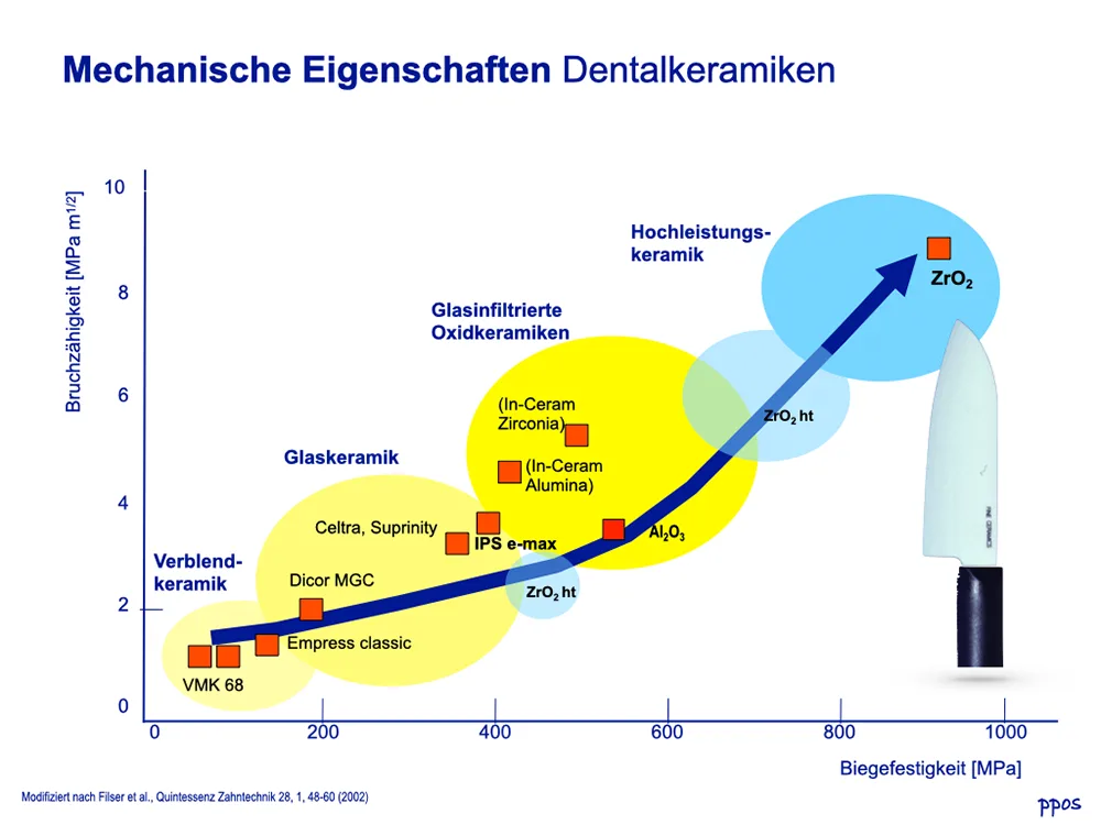 Abb. 1: Größenordnungen der Festigkeit verschiedener dentaler Keramiken