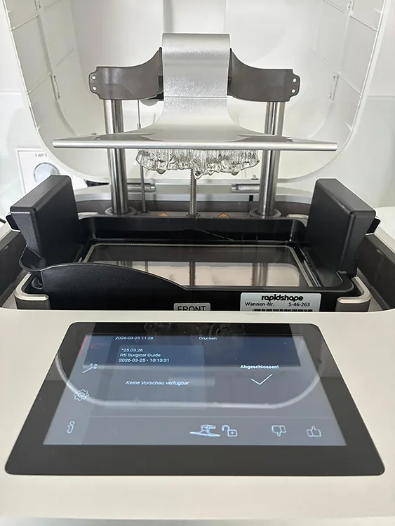 Abb. 1: Fertigung der Bohrschablone im 3D-Drucker.