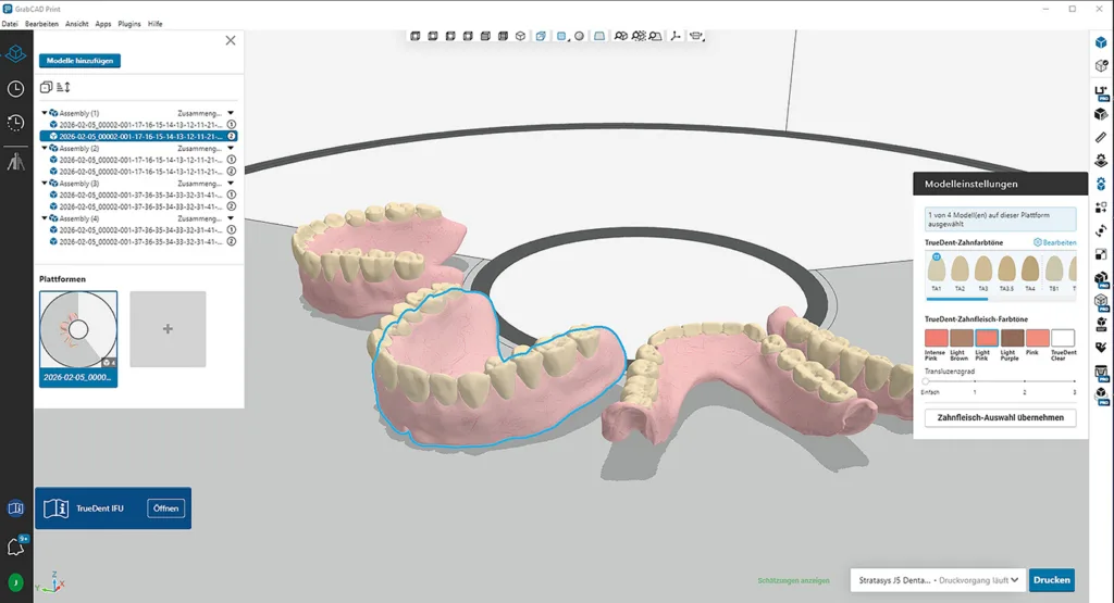 Abb. 13: In die Software werden die CAD-Konstruktionsdaten importiert, die Prothesenbasen zusammen mit den Zähnen automatisch auf der Bauplattform positioniert, die erforderlichen Stützstrukturen generiert und die TrueDent-Materialien sowie die dazugehörigen Farben zugeordnet.