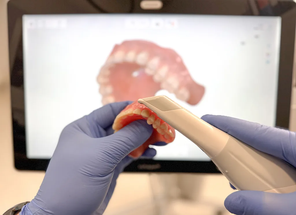 Abb. 2: … andererseits mittels Intraoralscanner (IO-Scanner) erfolgen.