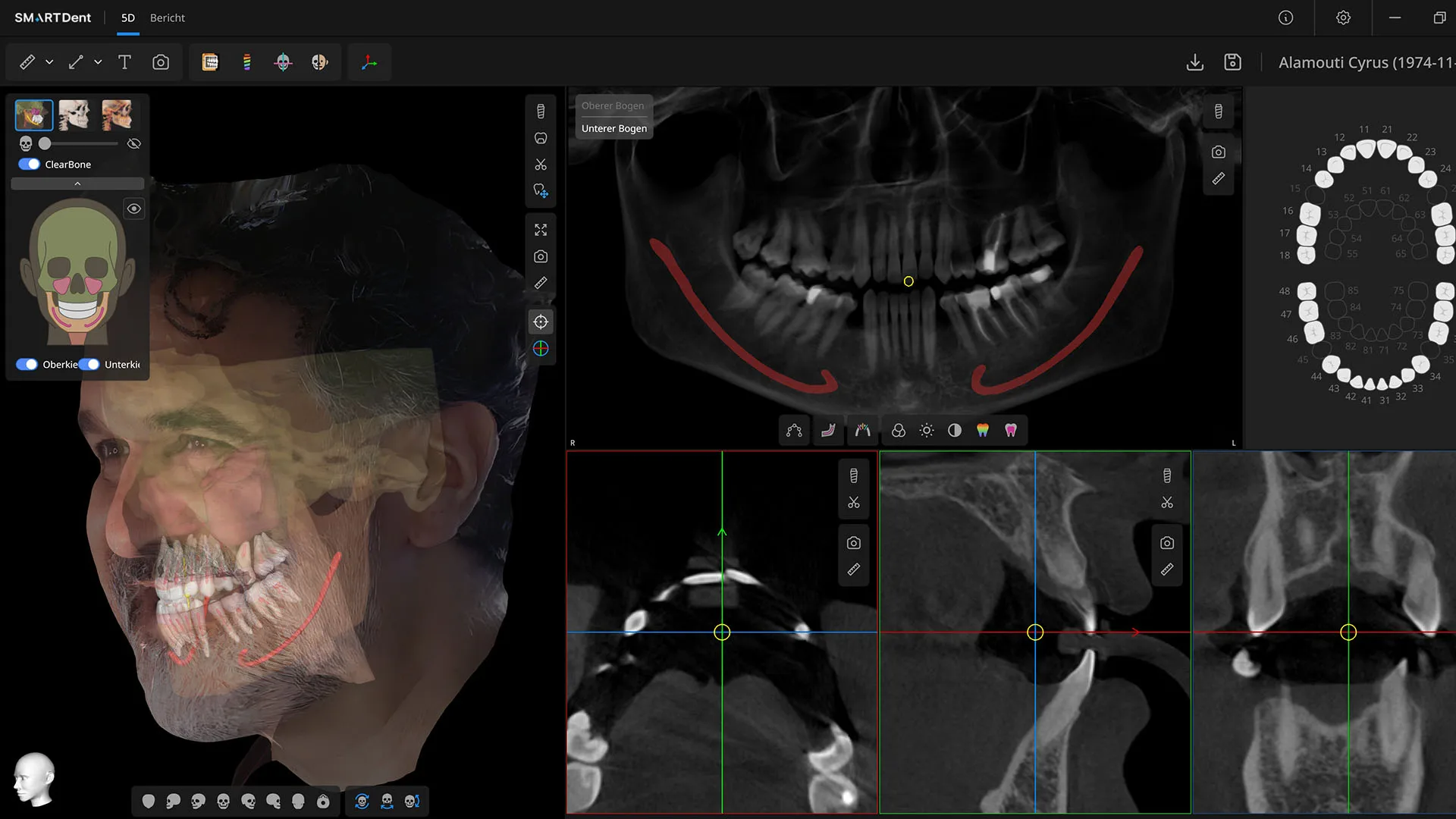 Die SMARTDent-Software zeigt exemplarisch, wie moderne DVT-Diagnostik und digitale Behandlungsplanung im Patientenworkflow zusammenwachsen. Interoperabilität ist ein zentrales Thema beim Campus Forum 2026.