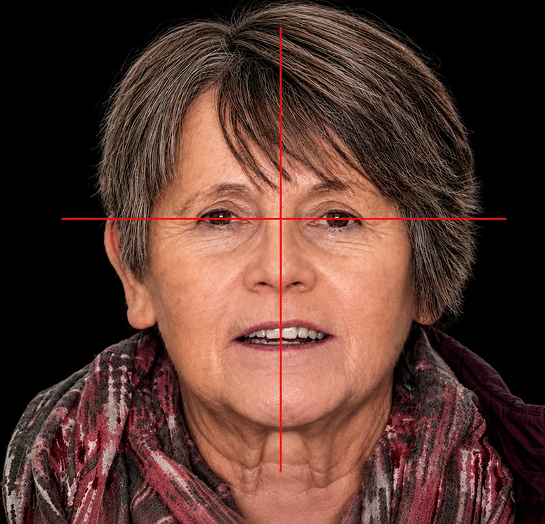 Abb.2: Analyse anhand eines Fotos.