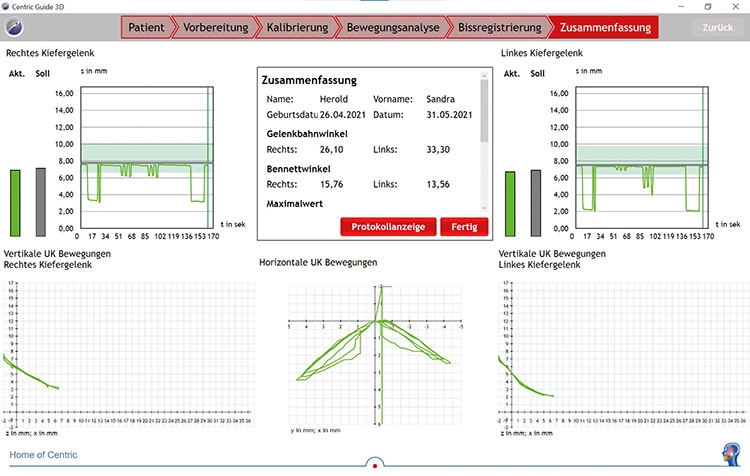 Abb. 4: Bissregistrierung.