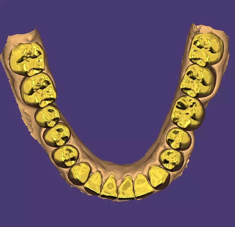 Abb. 3b.