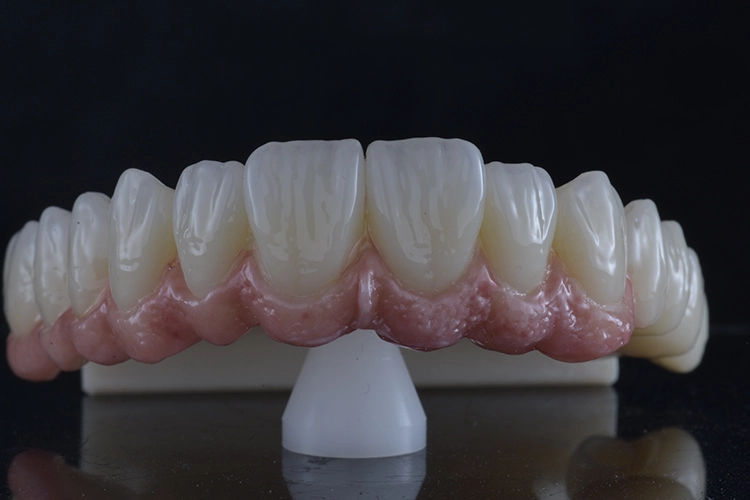 Abb. 4: Finales Ergebnis. Monolithische Restauration aus KATANA Zirconia YML.