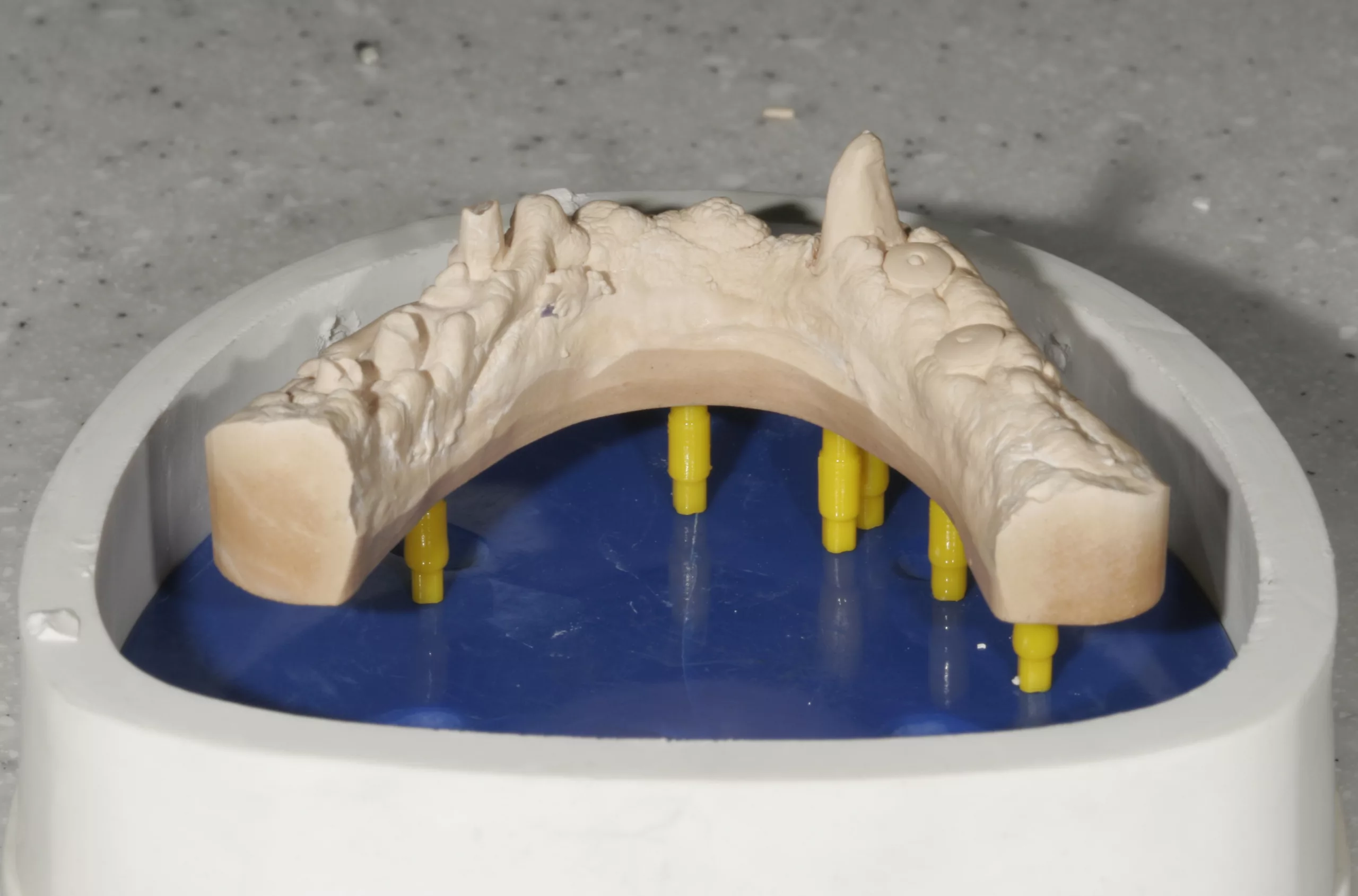Abb. 8: Gepinnt mit SAM-Stufenpins.