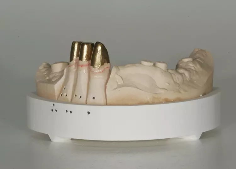 Abb. 12: Stümpfe sind vorbereitet.
