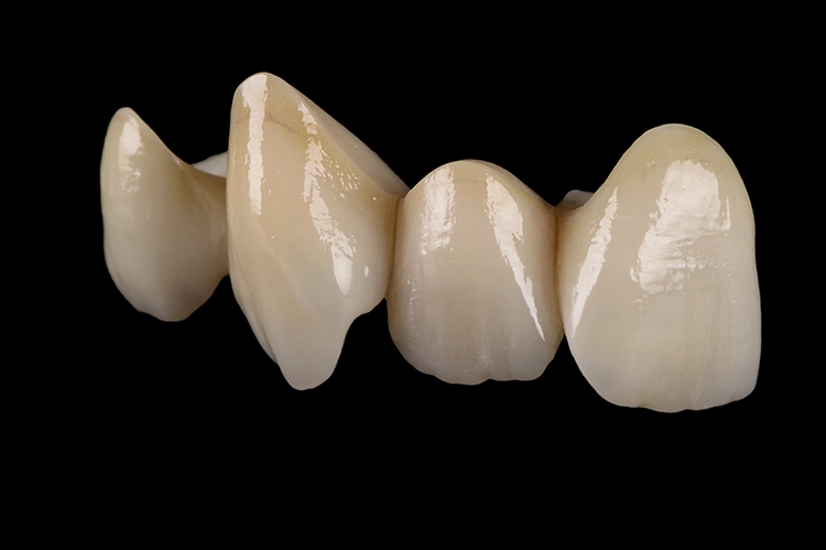 Brücke mit einer Biegefestigkeit im typischen Mittelwert: 1.100 MPa.