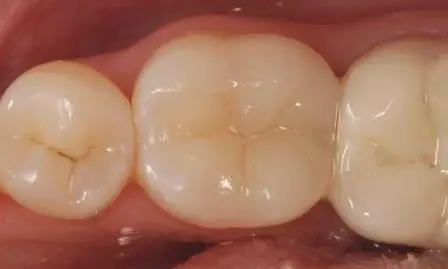 Exzellente Ästhetik durch das ausgewogene und übersichtliche Effekt-Farbkonzept.