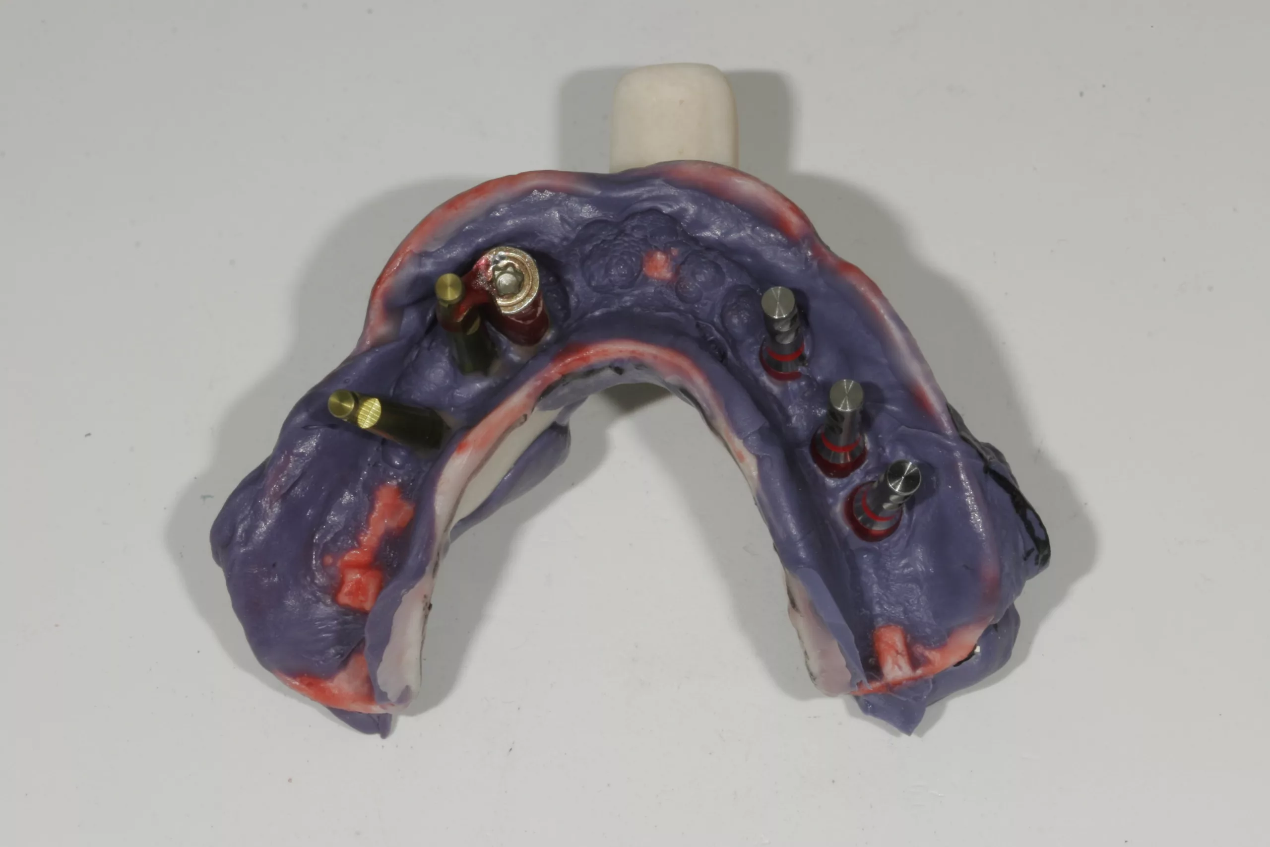 Abb. 25: Abformung mit Modellanalogen und Kunststoffstumpf.