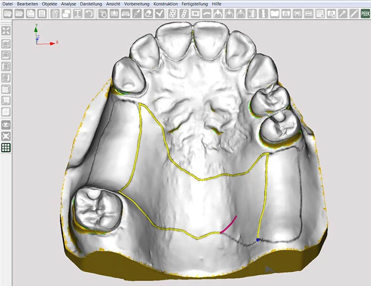 Abb. 2: Aktivierte Designlinie.
