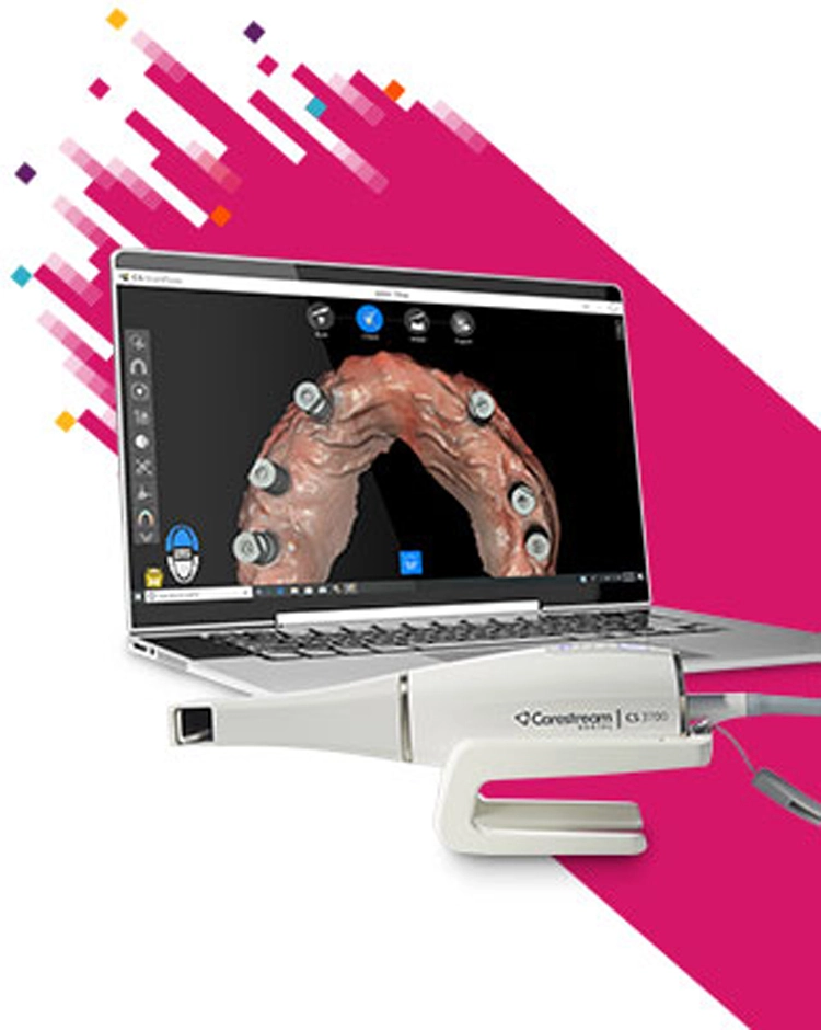 Erfolgreichen Neuprodukteinführungen des Intraoralscanners CS 3700.