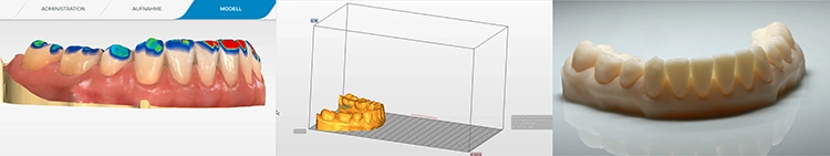 Cerec-Workflow ohne Fremdsoftware – von Scan zum schnellen Modell.