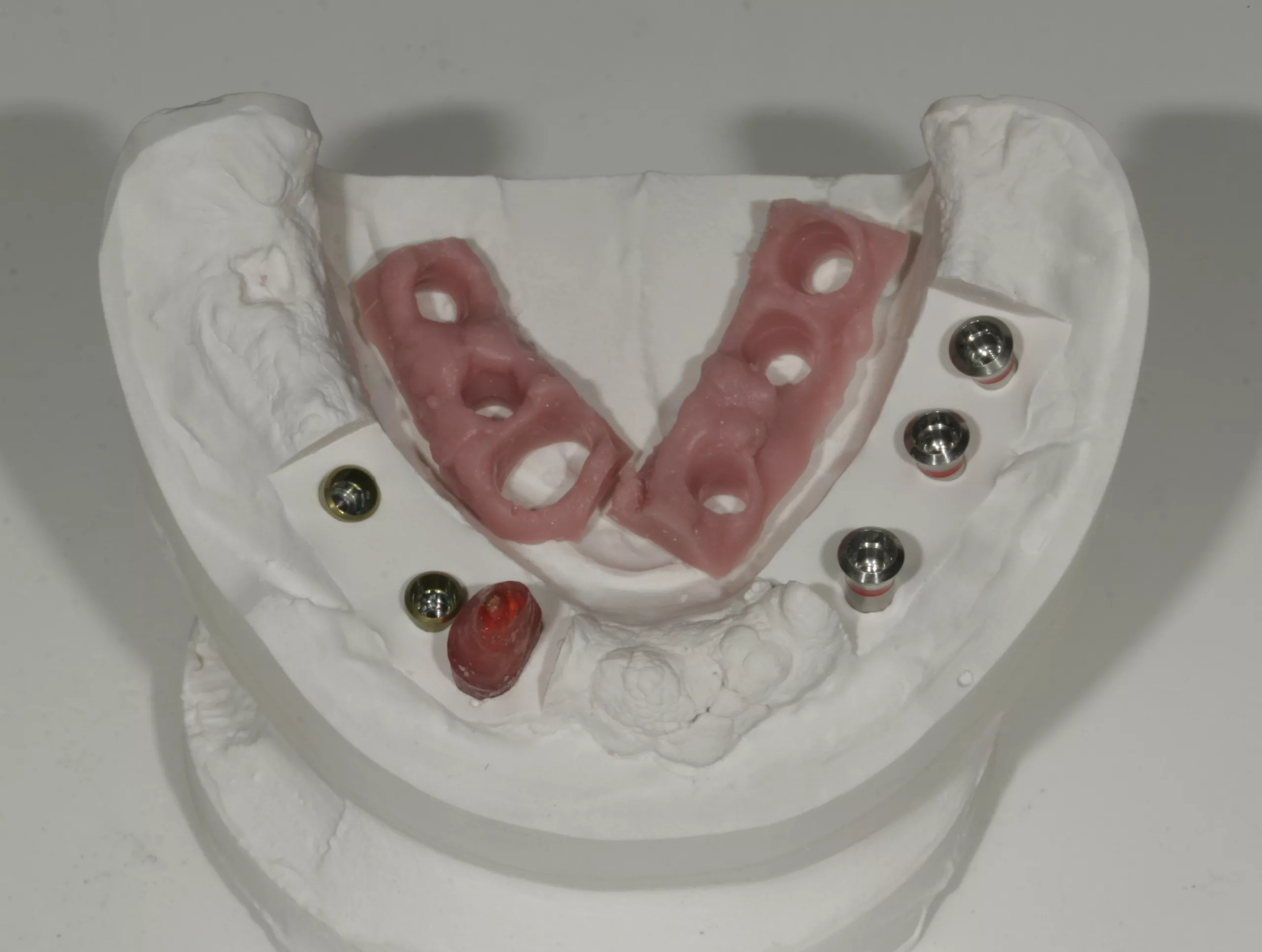 Abb. 38: GI-Mask abgenommen.