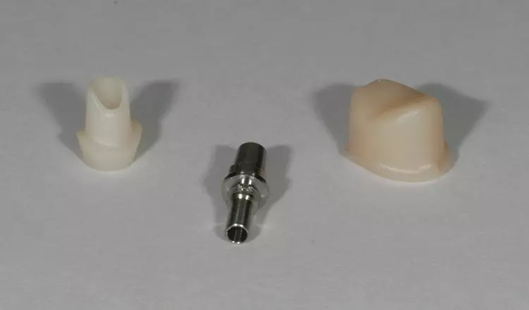 Abb. 3: Zirkonabutment offen und geschlossen.