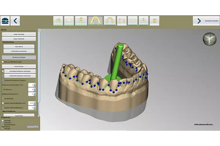 Abb. 3: Automatisch gelegte Spline.