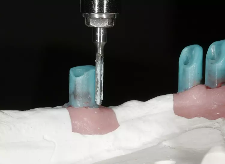 Abb. 46: Kontrolle mit Platinumvorwall.