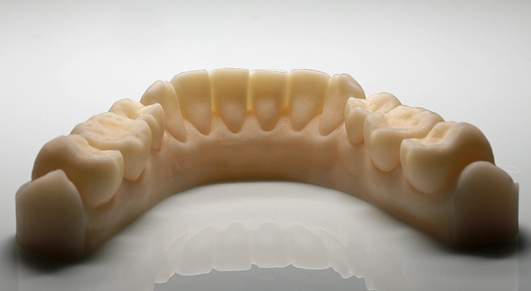 Abb. 5: Unterkiefermodell aus dem 3D-Drucker.
