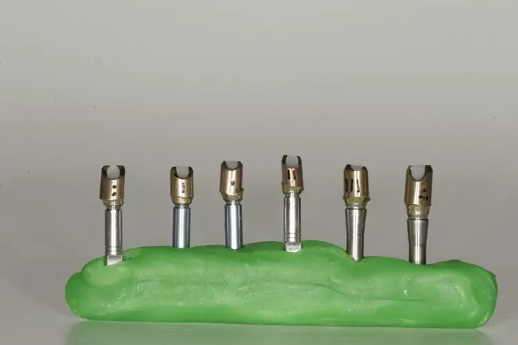 Abb. 64: Schraubenkanäle verschlossen.