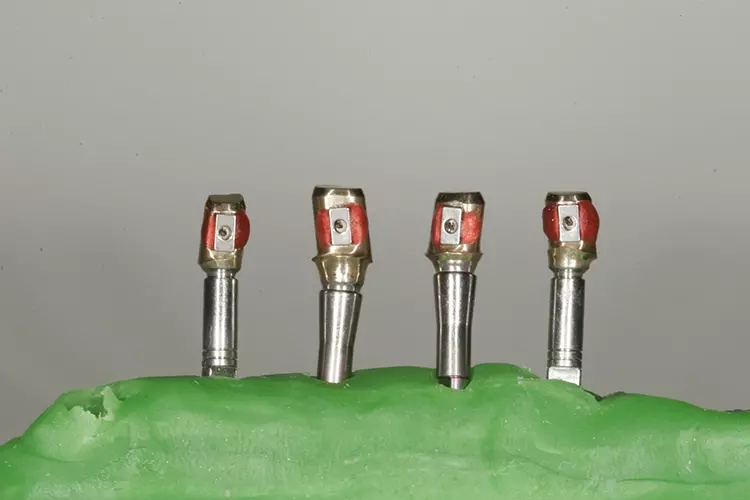 Abb. 65: Angussfähiger TK-Kasten fixiert.