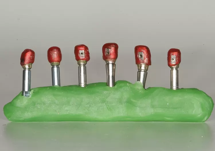 Abb. 66: Vollständiger Patternüberzug.