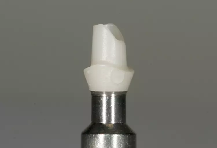 Abb. 7: Passungskontrolle Zirkonstumpf.