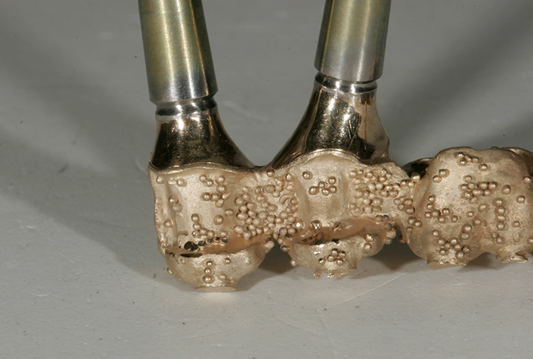 Abb. 86: Ideale Passung der Implantatteleskope.