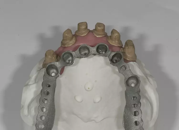 Abb. 97a: Haftvermittler aufgebracht und im Detail