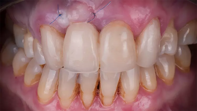 Abb. 10: Klinisches Bild nach 10 Tagen.