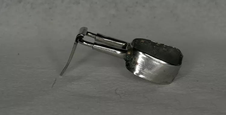 Abb. 11a u. b: Fester Lückenhalter im Band and Loop System (hier von DENOVO)
mit Distal Shoe (a) und dessen Inkorporation bei einem Patienten in regio 64/65.