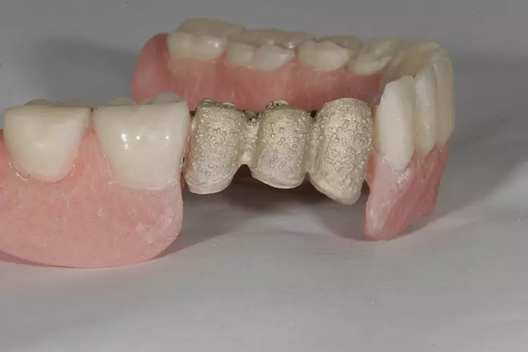 Abb. 124: Sandgestrahlt.