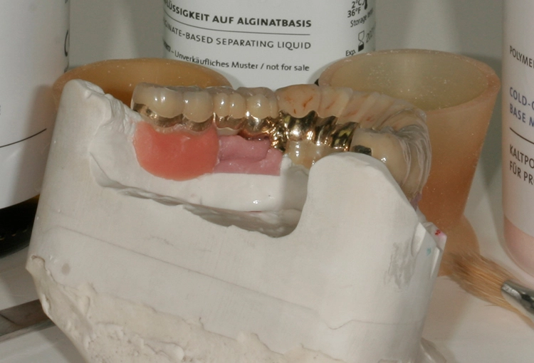 Abb. 136: Rosa Kunststoff aufgebracht.