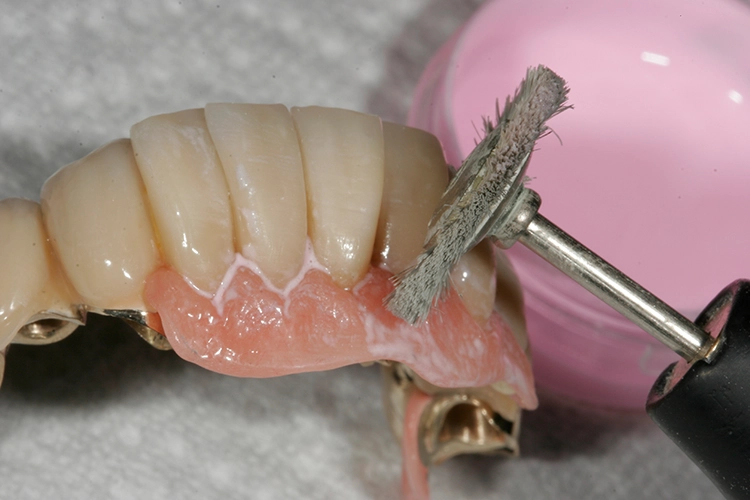 Abb. 137: Politur rosa Lippenschild.
