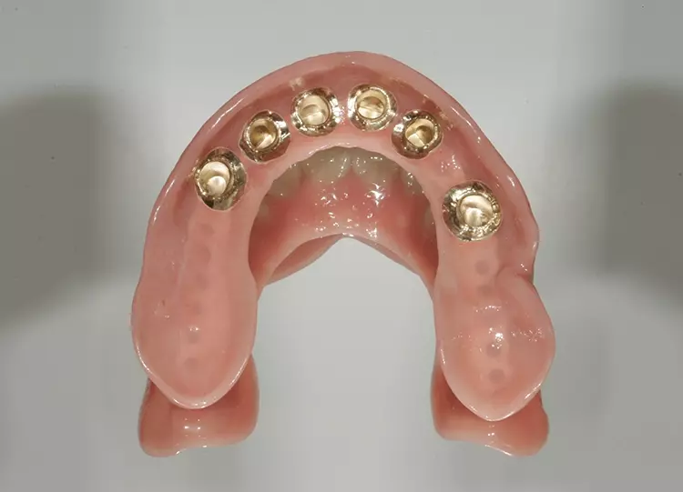 Abb. 137: Perfekte Innenflächen.
