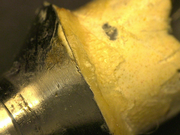 Abb. 13d: Abutment von labial in 20-facher Vergrößerung.