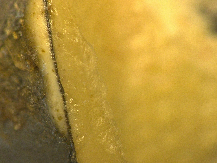 Abb. 13e: Abutment von labial in 150-facher Vergrößerung.