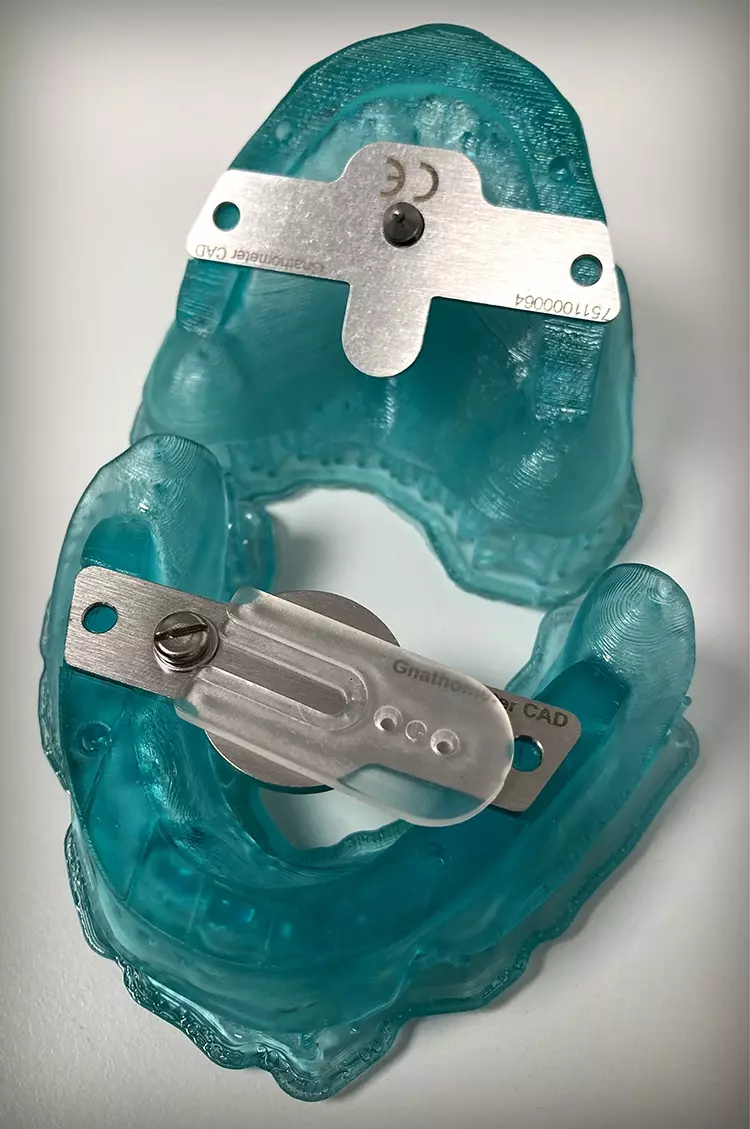 Abb. 14: Gedruckte individuelle Löffel
mit aufgesetzten Stützstiftregistraten
(Gnathometer CAD, Ivoclar).