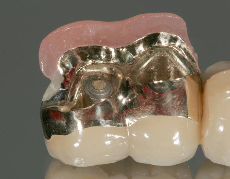 Abb. 143: Im Detail: TK-Snap, Goldschürze und rosa Ergänzung …