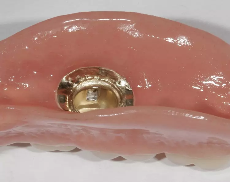 Abb. 148: Im Detail der Übergang Kunststoff zu Gold, beachtenswert der TK-Kasten.