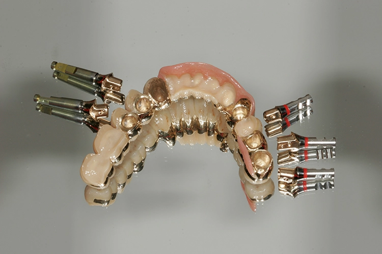 Abb. 149: Teleskopbrücke mit zugeordneten Abutments.