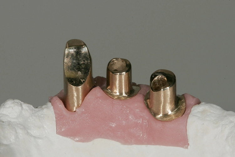 Abb. 152: Ausformung im 4. Quadranten.