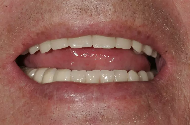 Abb. 154: Ein zufriedener Patient.