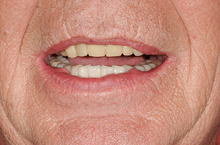 Abb. 167: Ein zufriedener Patient.
