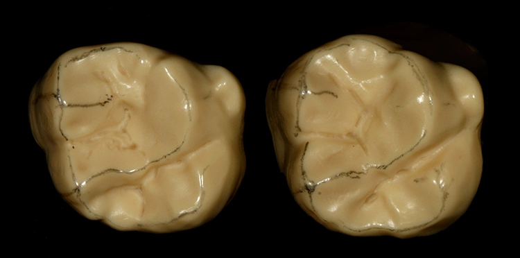 Abb. 18: Zahn 16 als Original und Zahn 26 als 16 gespiegelt.