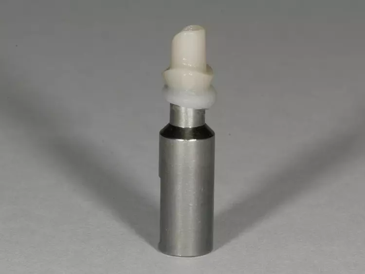 Abb. 18: Abutment nach der Reinigung.