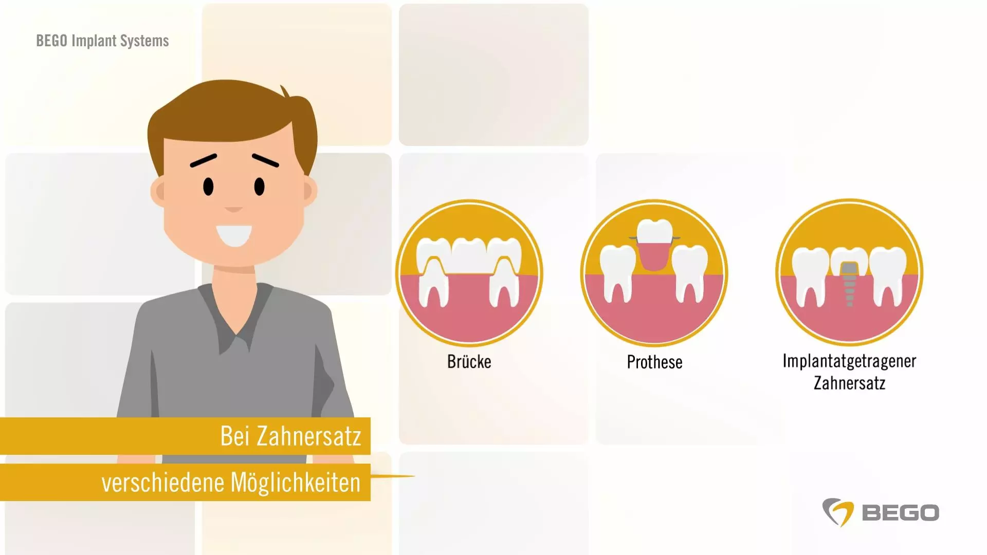 Das neue Video von BEGO Implant Systems beantwortet viele Patientenfragen zum Thema Zahnimplantate.