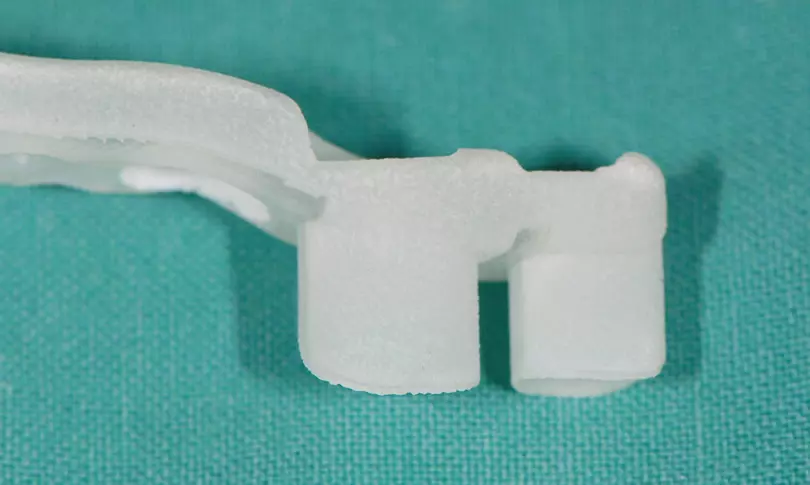 Abb. 19c: Zum Einsetzen bereit: CAD/CAM-Abutments, vollkeramische Kronen, Übertragungsschlüssel.