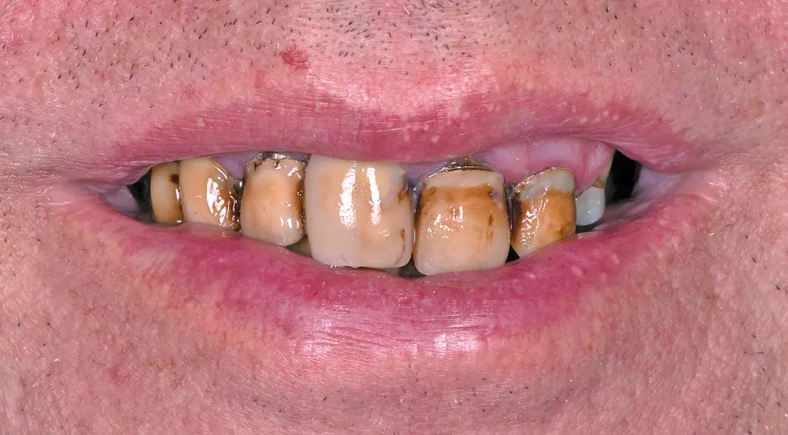 Abb. 1a: Ausgangssituation (Lachbild).